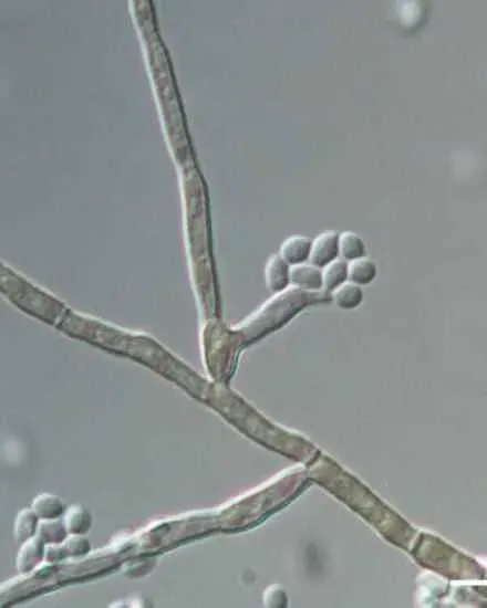Microscopic view of slender fungal hyphae and round spore‑like conidia clusters